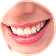 Riabilitazione Immediata, torni a sorridere in 24h